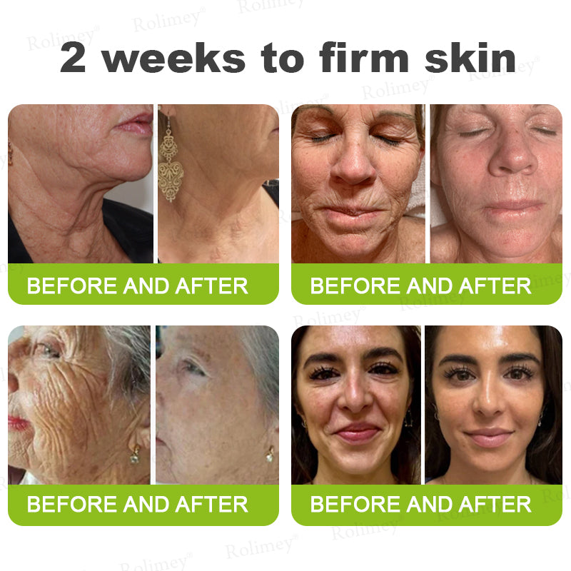 💫💫Made and shipped from the UK 💫Rolimey® Botox & Vita-A Retinol Shot Wrinkle-Lift Tightening cream - Last Day Promotion 50% OFF