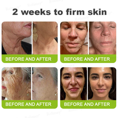 💫💫Made and shipped from the UK 💫Rolimey® Botox & Vita-A Retinol Shot Wrinkle-Lift Tightening cream - Last Day Promotion 50% OFF