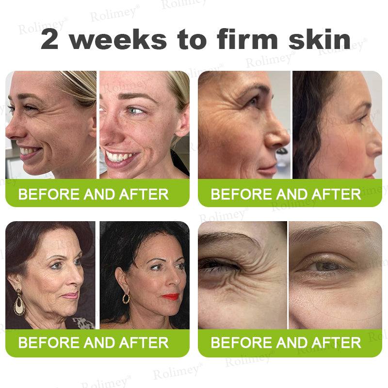 💫💫Made and shipped from the UK 💫Rolimey® Botox & Vita-A Retinol Shot Wrinkle-Lift Tightening cream - Last Day Promotion 50% OFF