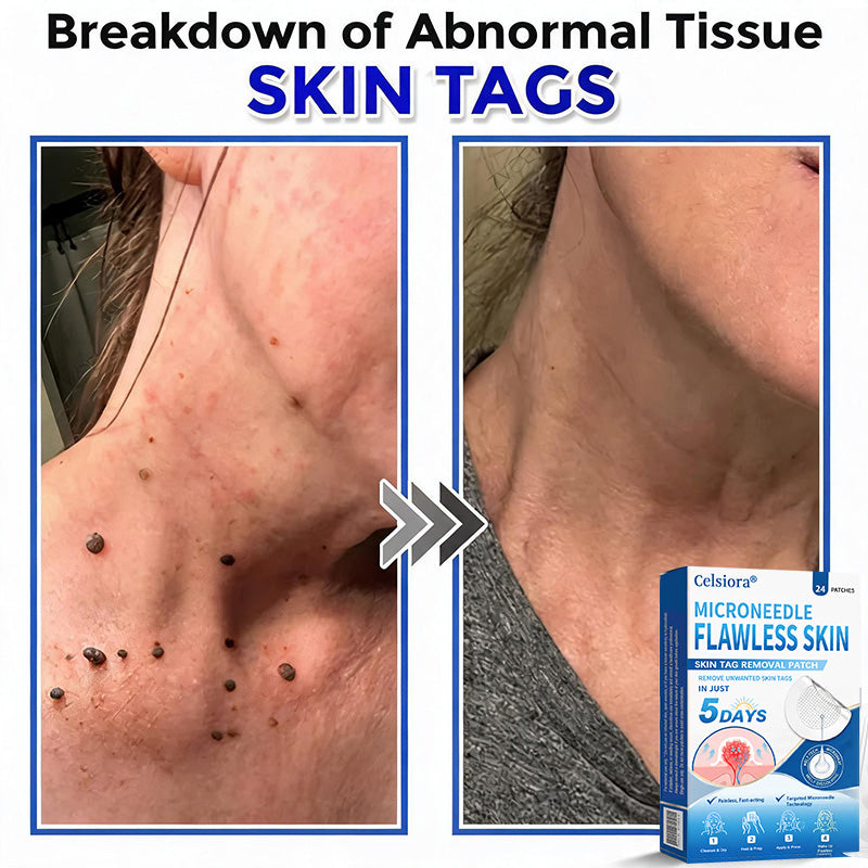 👑☘️Celsiora® 2-in-1 Microneedle & Hydrocolloid Patch | Raised Moles,Acne, Flat Warts & Skin Tags Remover | Improves Wrinkles, Scars & Blemishes | Invisible Pimple Patches for Face & Body | 24 Count