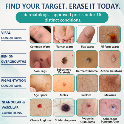 🇬🇧🌿✨Celsiora® 7 Day Wart & Skin Tag Remover Foam (Targeted Solution for Warts, Skin Tags & Uneven Skin Texture)