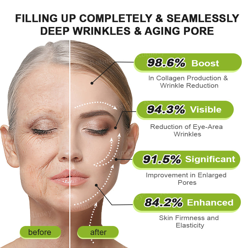 💫💫Made and shipped from the UK 💫Rolimey® Botox & Vita-A Retinol Shot Wrinkle-Lift Tightening cream - Last Day Promotion 50% OFF