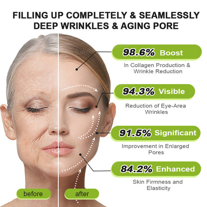 💫💫Made and shipped from the UK 💫Rolimey® Botox & Vita-A Retinol Shot Wrinkle-Lift Tightening cream - Last Day Promotion 50% OFF
