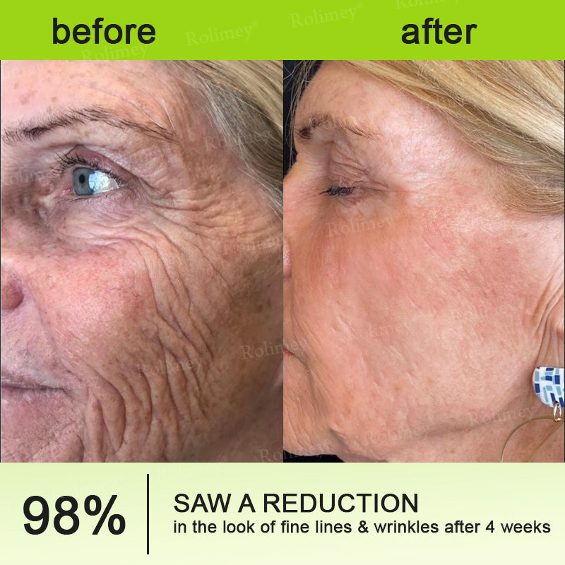 💫💫Made and shipped from the UK 💫Rolimey® Botox & Vita-A Retinol Shot Wrinkle-Lift Tightening cream - Last Day Promotion 50% OFF