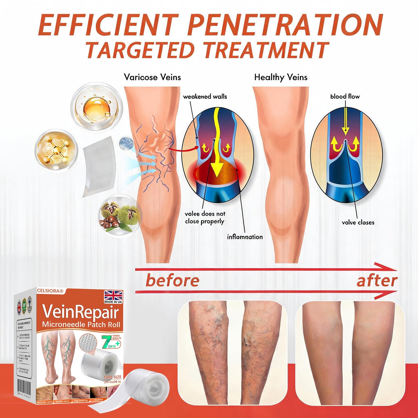 🌿🌿Official UK Store 🇬🇧 | Celsiora® Vein Ease Microneedle Care Patch(For Spider Veins, Varicose Veins, Swelling & Leg Fatigue) - Last Day Promotion 50% OFF