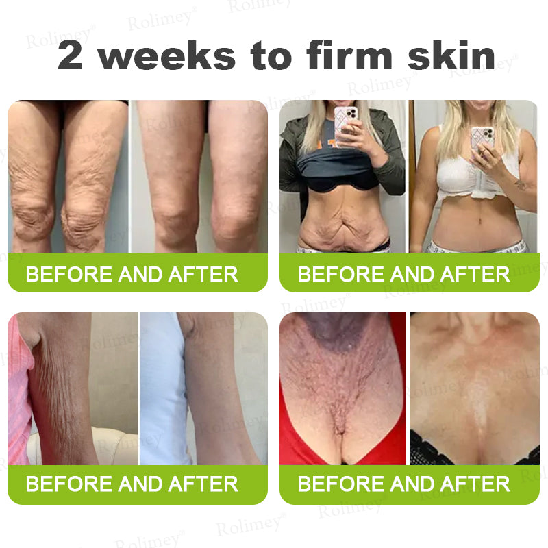 💫💫Made and shipped from the UK 💫Rolimey® Botox & Vita-A Retinol Shot Wrinkle-Lift Tightening cream - Last Day Promotion 50% OFF