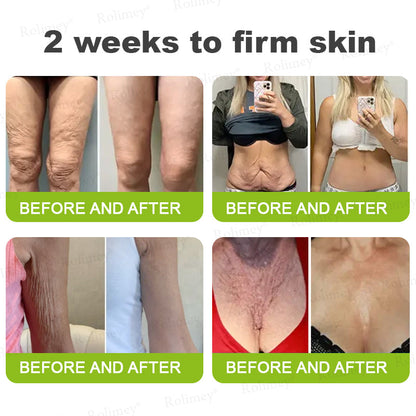 💫💫Made and shipped from the UK 💫Rolimey® Botox & Vita-A Retinol Shot Wrinkle-Lift Tightening cream - Last Day Promotion 50% OFF