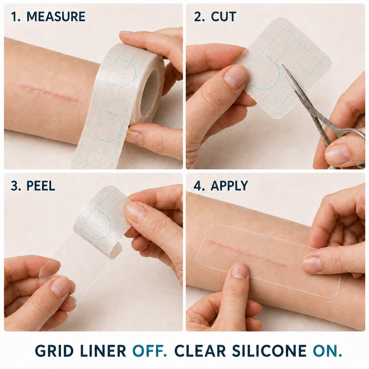 🇬🇧🌿👩‍⚕️TRILUMIA® SILICONE SCAR THERAPY ROLL  Help Soften, Flatten & Improve the Appearance of Raised Scars