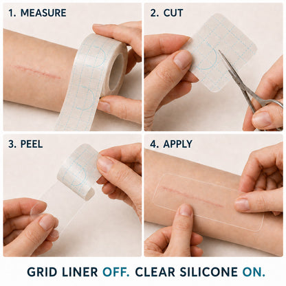 🇬🇧🌿👩‍⚕️TRILUMIA® SILICONE SCAR THERAPY ROLL  Help Soften, Flatten & Improve the Appearance of Raised Scars