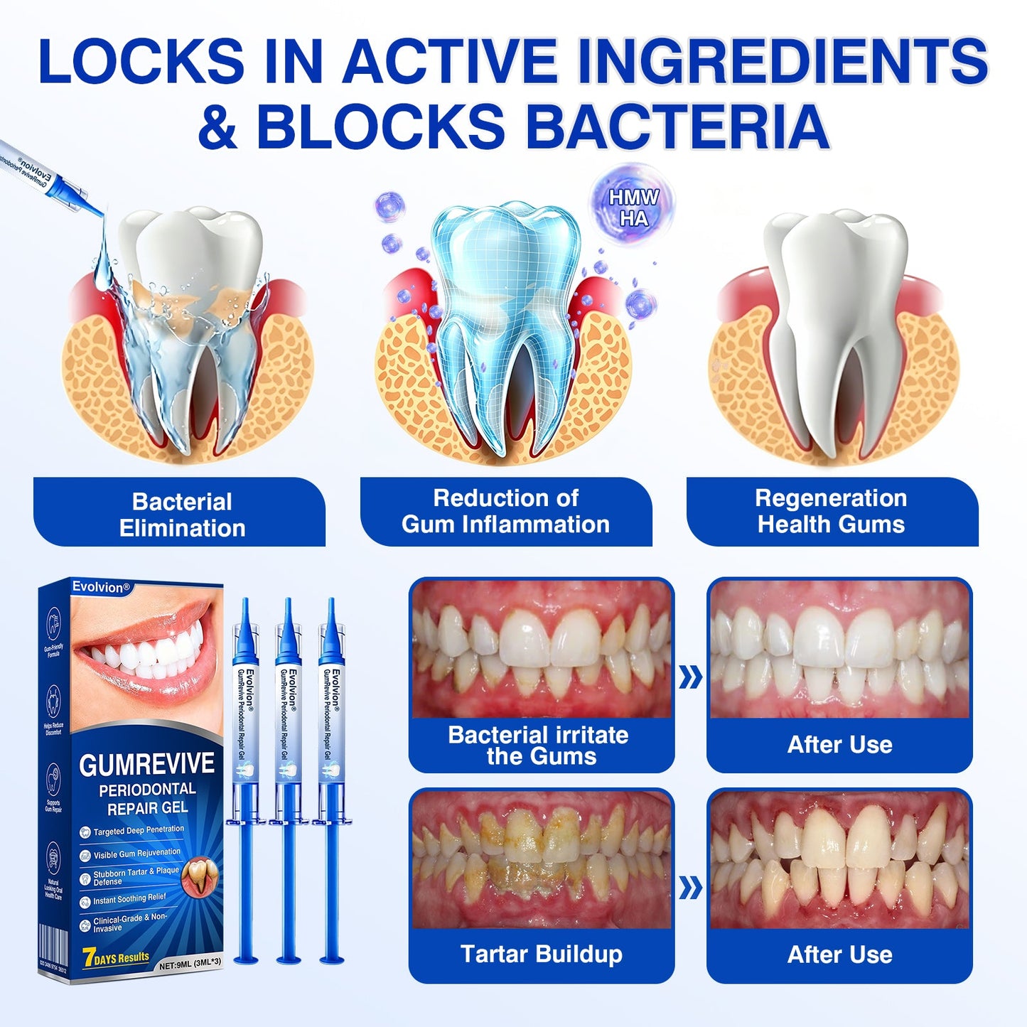 🇬🇧👨‍⚕️🦷🛡️Evolvion® GumRevive Periodontal Repair Gel