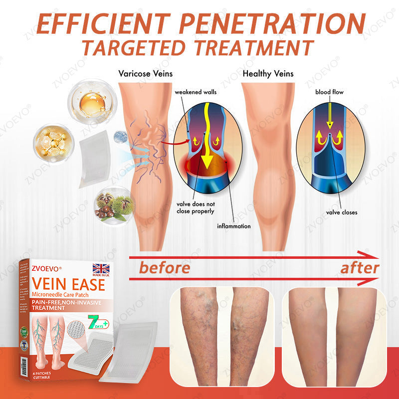 👨‍⚕️Zvoevo® Vein Ease Microneedle Care Patch(For Spider Veins, Varicose Veins, Swelling & Leg Fatigue) - Last Day Promotion 50% OFF