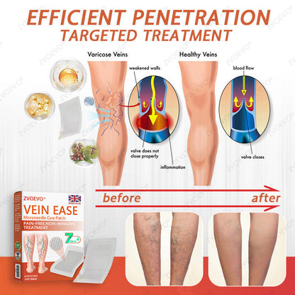 👨‍⚕️Zvoevo® Vein Ease Microneedle Care Patch(For Spider Veins, Varicose Veins, Swelling & Leg Fatigue) - Last Day Promotion 50% OFF