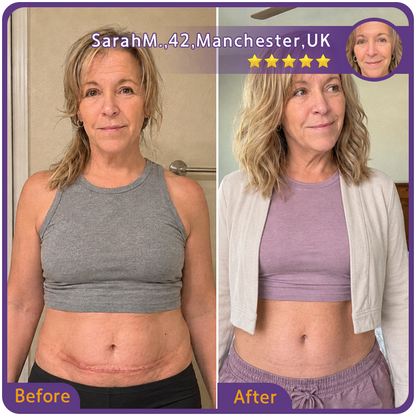 🇬🇧👨‍⚕️🌿Trilumia® Medical-Grade Silicone Scar Repair Roller (For Raised, Red, Firm, Tight & Discoloured Surgical Scars)