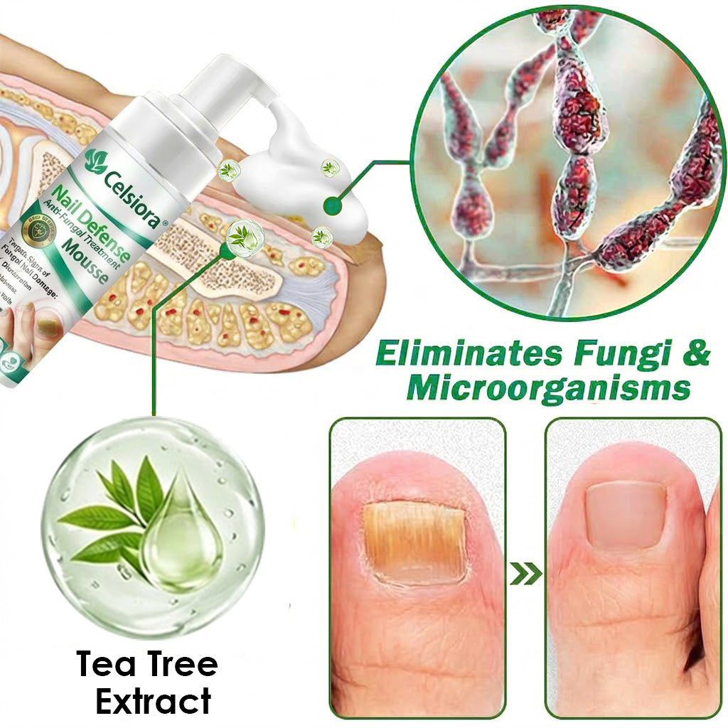 💯👩‍⚕️Official UK Store 🇬🇧 | Celsiora® Max Strength Nail Defense Anti-Fungal Treatment Mousse (Clinically formulated for severe discoloration, keratin thickening, and deep-seated fungal damage.)