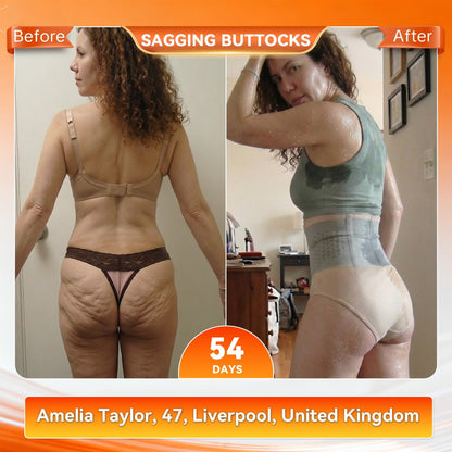 💯👩‍⚕️Official UK Store 🇬🇧|Sugoola® 𝐌𝐨𝐫𝐢𝐧𝐠𝐚 & 𝐁𝐞𝐫𝐛𝐞𝐫𝐢𝐧𝐞 4‑In‑1 Micro‑Particle Sculpting & Fat‑Burn Shorts