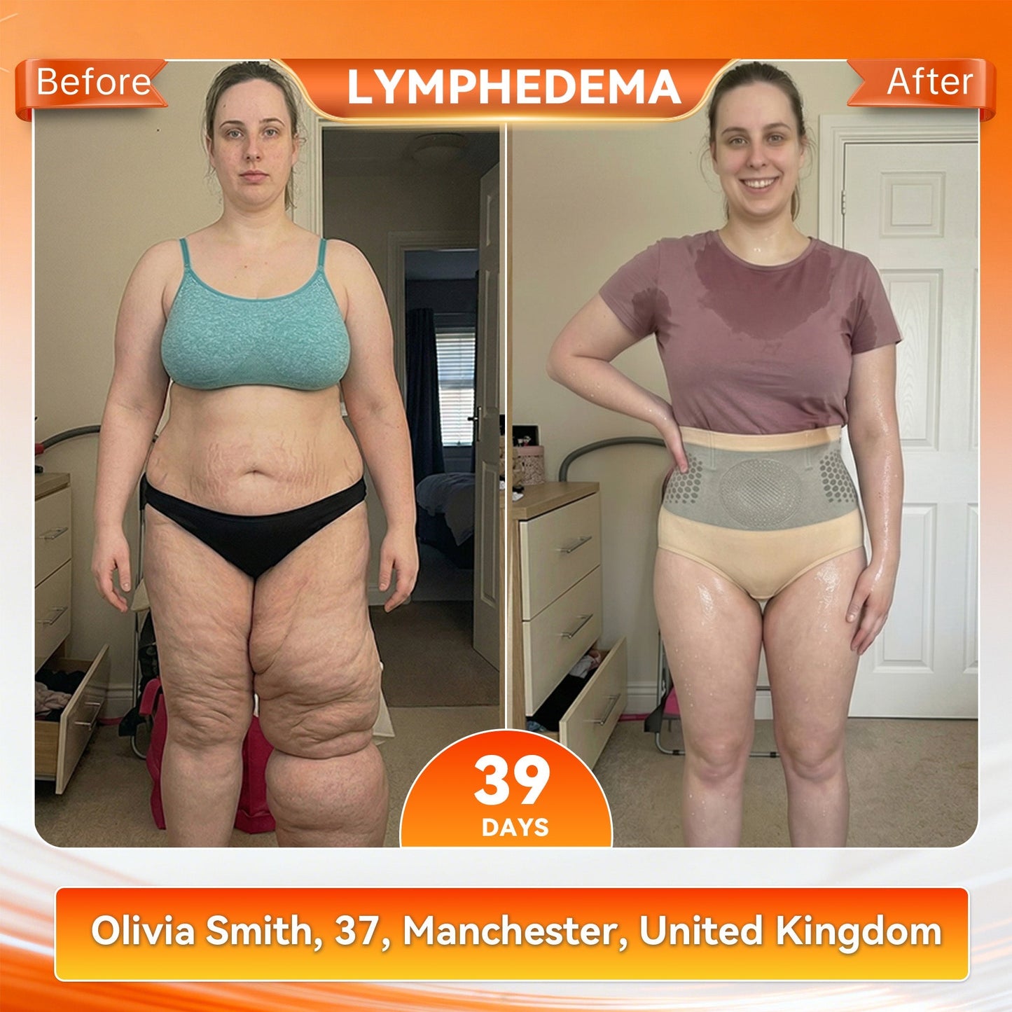 💯👩‍⚕️Official UK Store 🇬🇧|Sugoola® 𝐌𝐨𝐫𝐢𝐧𝐠𝐚 & 𝐁𝐞𝐫𝐛𝐞𝐫𝐢𝐧𝐞 4‑In‑1 Micro‑Particle Sculpting & Fat‑Burn Shorts