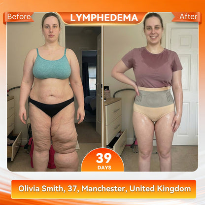 💯👩‍⚕️Official UK Store 🇬🇧|Sugoola® 𝐌𝐨𝐫𝐢𝐧𝐠𝐚 & 𝐁𝐞𝐫𝐛𝐞𝐫𝐢𝐧𝐞 4‑In‑1 Micro‑Particle Sculpting & Fat‑Burn Shorts