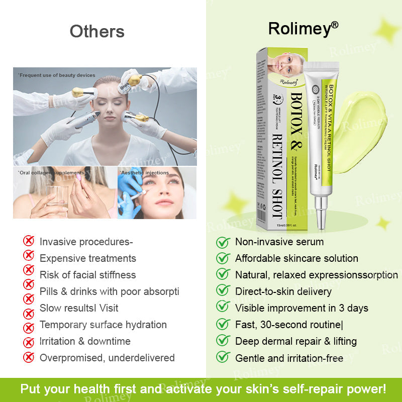 💫💫Made and shipped from the UK 💫Rolimey® Botox & Vita-A Retinol Shot Wrinkle-Lift Tightening cream - Last Day Promotion 50% OFF