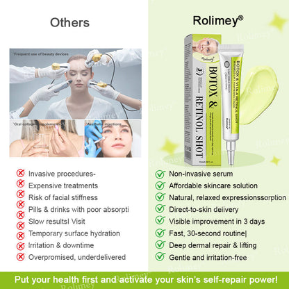 💫💫Made and shipped from the UK 💫Rolimey® Botox & Vita-A Retinol Shot Wrinkle-Lift Tightening cream - Last Day Promotion 50% OFF