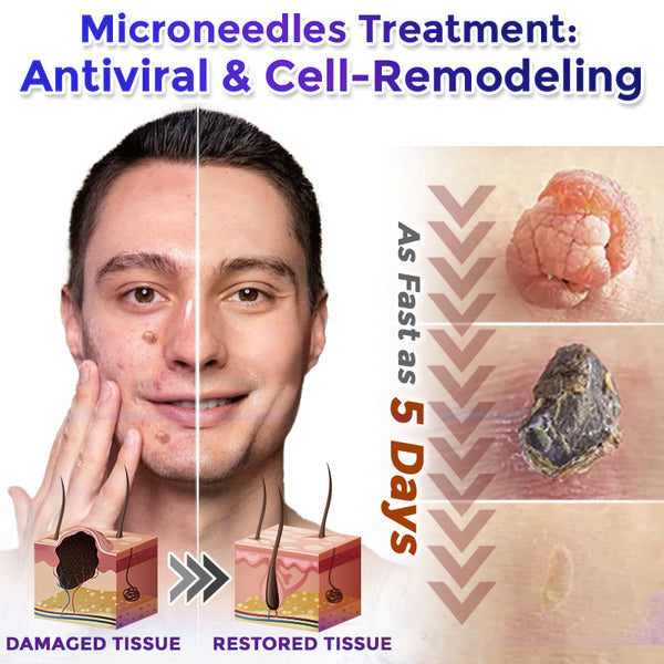 👑☘️Celsiora® 2-in-1 Microneedle & Hydrocolloid Patch | Raised Moles,Acne, Flat Warts & Skin Tags Remover | Improves Wrinkles, Scars & Blemishes | Invisible Pimple Patches for Face & Body | 24 Count