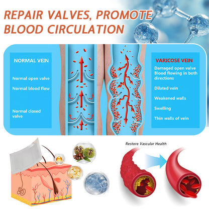 🌿🌿Official UK Store 🇬🇧 | Celsiora® Vein Ease Microneedle Care Patch(For Spider Veins, Varicose Veins, Swelling & Leg Fatigue) - Last Day Promotion 50% OFF