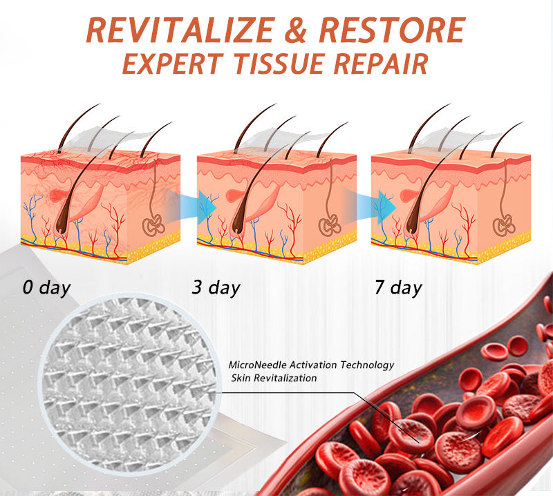 🌿🌿Official UK Store 🇬🇧 | Celsiora® Vein Ease Microneedle Care Patch(For Spider Veins, Varicose Veins, Swelling & Leg Fatigue) - Last Day Promotion 50% OFF
