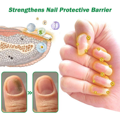 💯👩‍⚕️Official UK Store 🇬🇧 | Celsiora® Max Strength Nail Defense Anti-Fungal Treatment Mousse (Clinically formulated for severe discoloration, keratin thickening, and deep-seated fungal damage.)