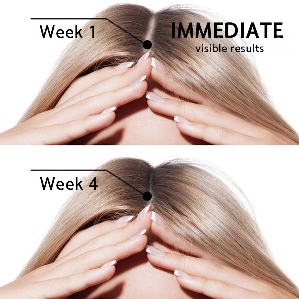 👨‍⚕️✅ Official UK Store 🇬🇧 | 🔥Rolimey® Highly Effective Biotin & Rosemary Hair Growth Serum — Visibly fills thinning areas & receding hairlines (🔥 Limited-Time Offer, ⏳ Last 30 Minutes)