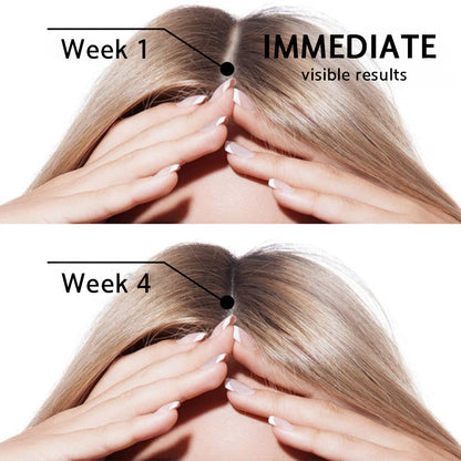 👨‍⚕️✅ Official UK Store 🇬🇧 | 🔥Rolimey® Highly Effective Biotin & Rosemary Hair Growth Serum — Visibly fills thinning areas & receding hairlines (🔥 Limited-Time Offer, ⏳ Last 30 Minutes)